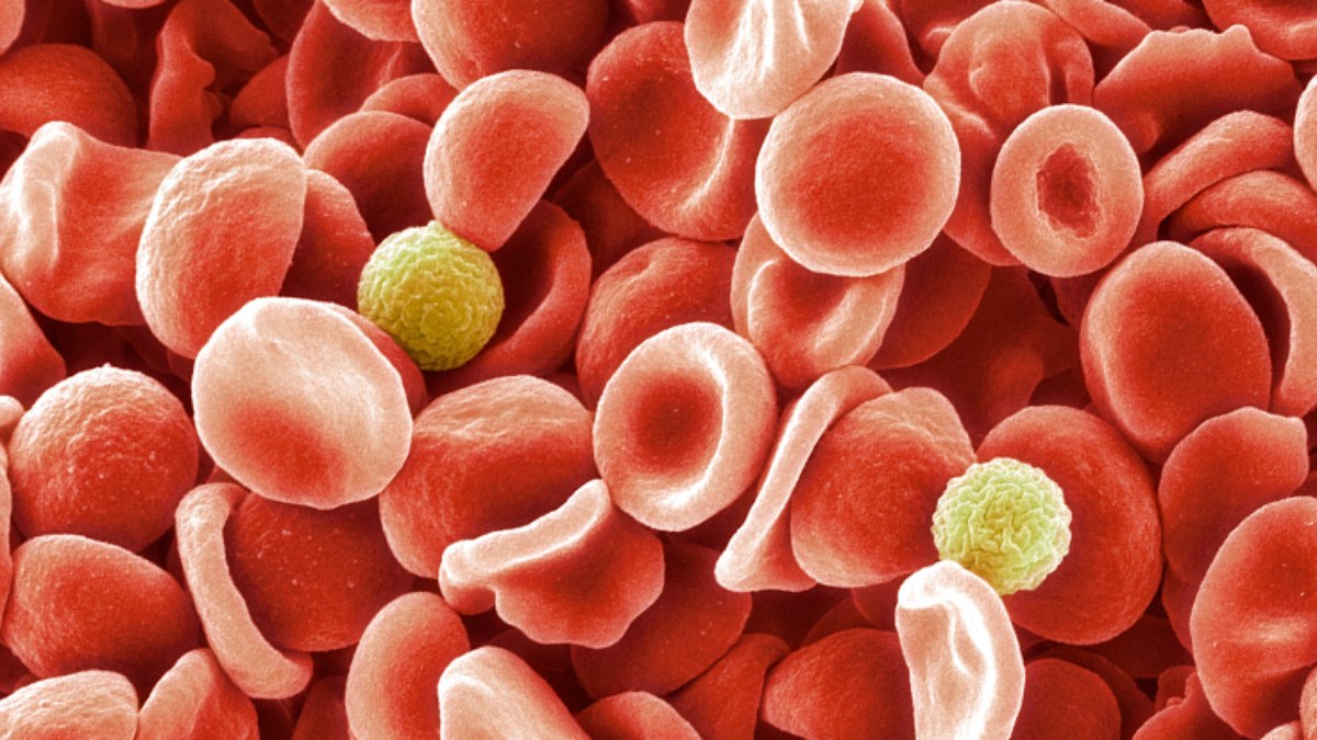 Pesquisadores esclarecem a ausência de um antígeno em amostras de sangue de 1972 Pesquisadores esclarecem a ausência de um antígeno em amostras de sangue de 1972