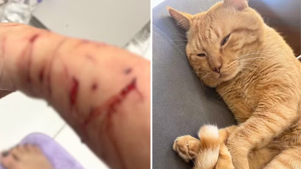 Gato ataca tutora e faz família de refém na própria casa: 'Preservação da minha vida'