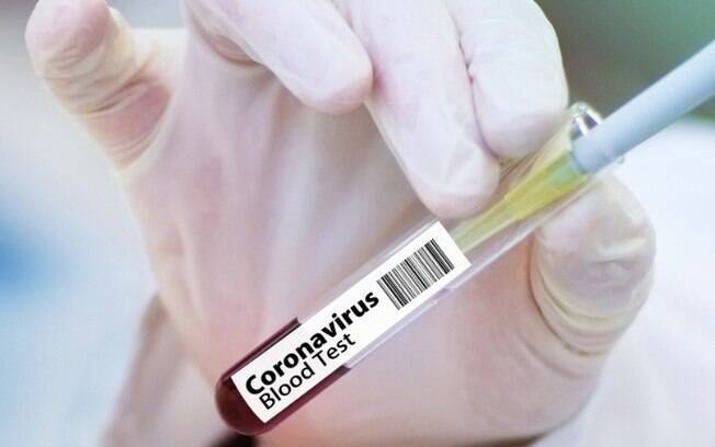 Cosmópolis atinge 100% de ocupação de UTI para coronavírus