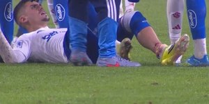 Jogador do Cruzeiro sofre fratura na perna após falta violenta