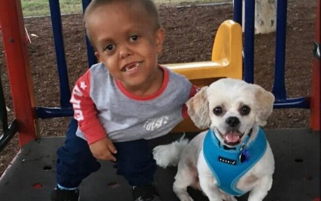 Quaden tem 4 anos e seu cachorro o ajudou a aceitar doença