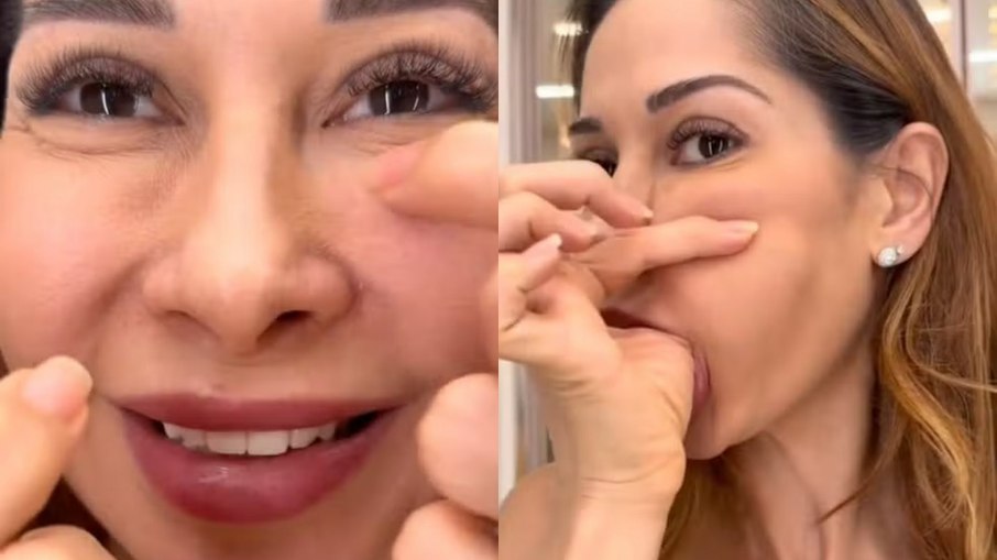 Maíra Cardi fala sobre deformação na face