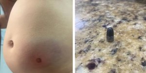 Bebê de 11 meses é atingida por bala perdida durante réveillon