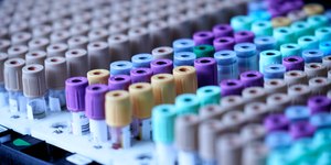 Exame de sangue detecta mais de 50 tipos de câncer