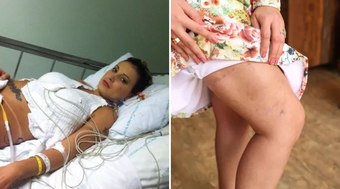 Andressa Urach passou por mais de 20 cirurgias; veja quais foram