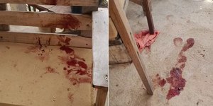 Bebê de 10 meses morre após ataque de pitbull no Rio