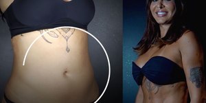 Alinne Rosa mostra antes e depois de lipo LAD e surpreende; veja fotos