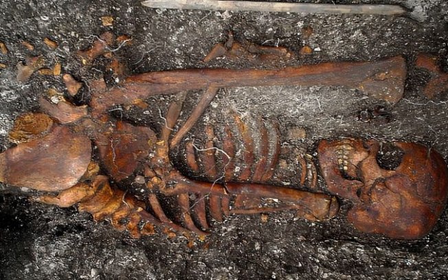 Evidência mais antiga de sífilis é encontrada em esqueletos no Brasil