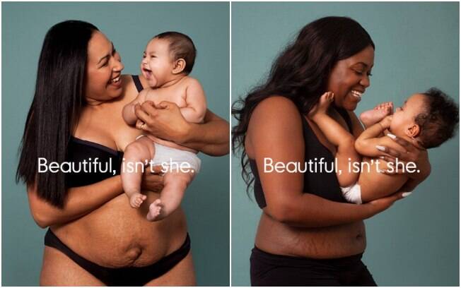 Campanha do Reino Unido propõe celebrar as mudanças do corpo pós-parto, com suas marcas, estrias e flacidez