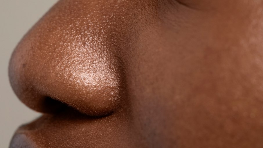 Poros dilatados: o que funciona e o que é mito na dermatologia