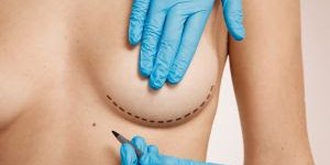 “Nem sempre é possível reconstruir a mama no momento da mastectomia”