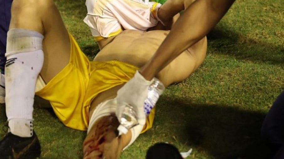 Goleiro do Grêmio Anápolis ficou no chão após levar tiro na perna esquerda