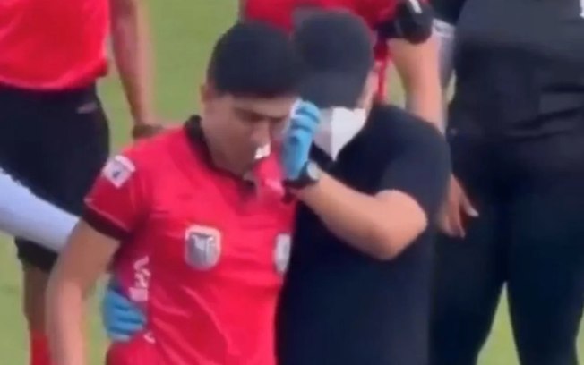 Jhon Perlaza, do Ciudad de Yantzaza, arremessou uma pedra no rosto do assistente Lenin Ojeda 