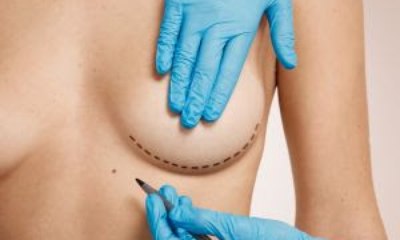10 dicas para uma cirurgia de mama bem-sucedida
