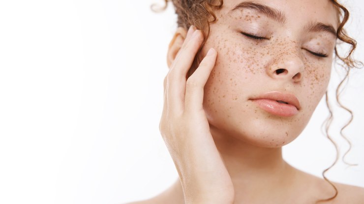 Entenda por que o melasma pode piorar no inverno