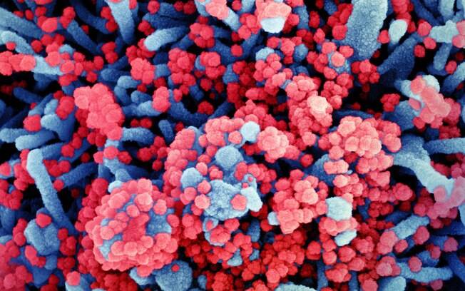 Novo coronavírus pode ter sido originado em vírus encontrado na China ainda em 2013
