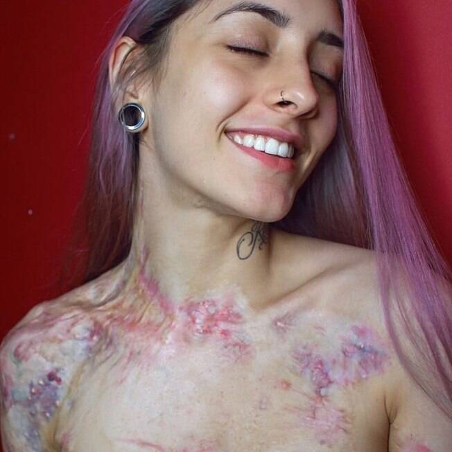 mulher com cicatriz