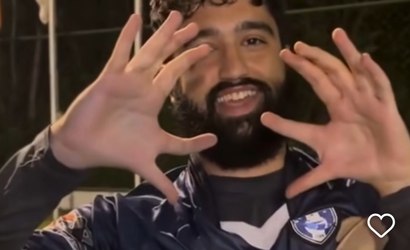 Polidactilia: condição de goleiro com 6 dedos vem desde a bisavó