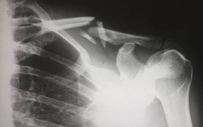 Google quase divulgou 100 mil imagens de raios X