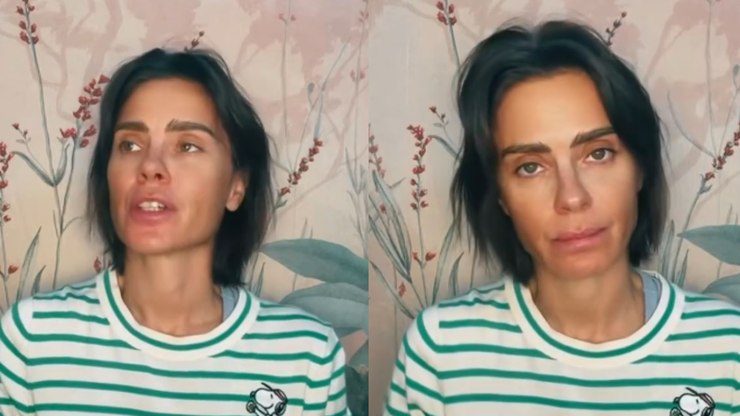 Carolina Dieckmann faz alerta após infecção grave: "Pode matar"