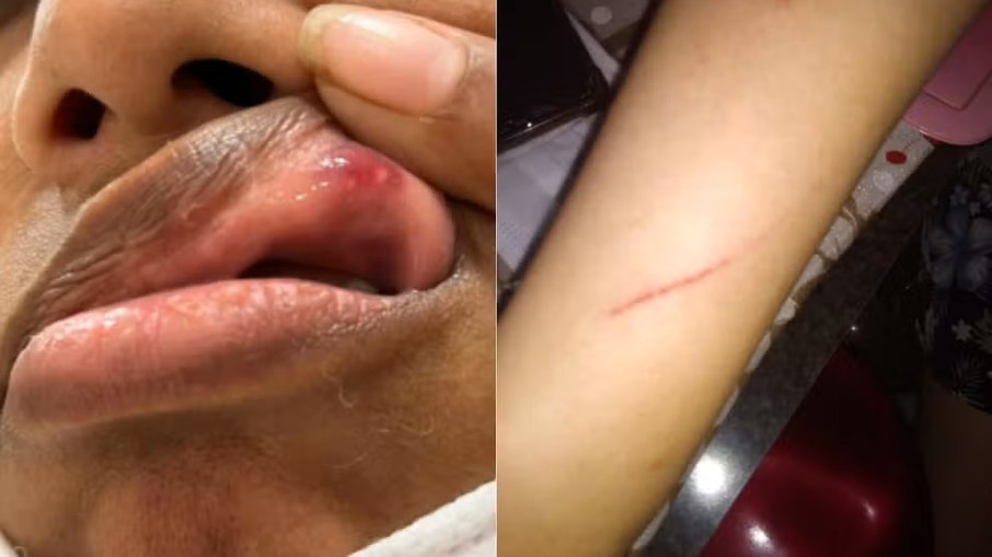 Mãe e filha sofrerem agressões