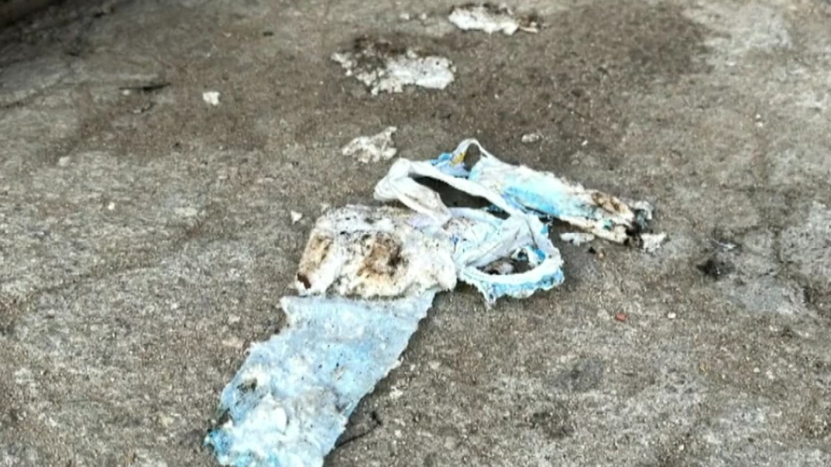 Bebê morre após ter corpo queimado em Cabo Frio Bebê morre após ter corpo queimado em Cabo Frio