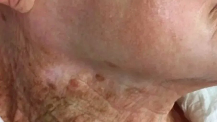 Imagem de idosa que cuidou do rosto, mas não do pescoço, viralizou