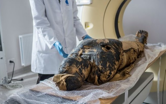 Múmia egípcia morreu durante o parto com bebê preso na pelve