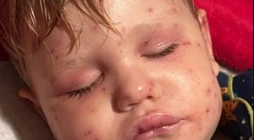 Vídeo mostra ataque de drones ucranianos a soldados russos