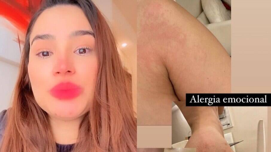 Raissa Barbosa chora por alergia emocional