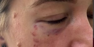 Brasil bate recorde de violência contra mulheres em 2024