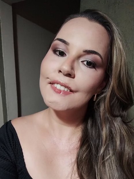 Resultado da cirurgia de reconstrução labial