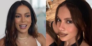 Anitta surpreende fãs ao debutar "novo rosto" após infecção