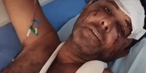Homem de 51 anos é atacado por onça-pintada em Goiás