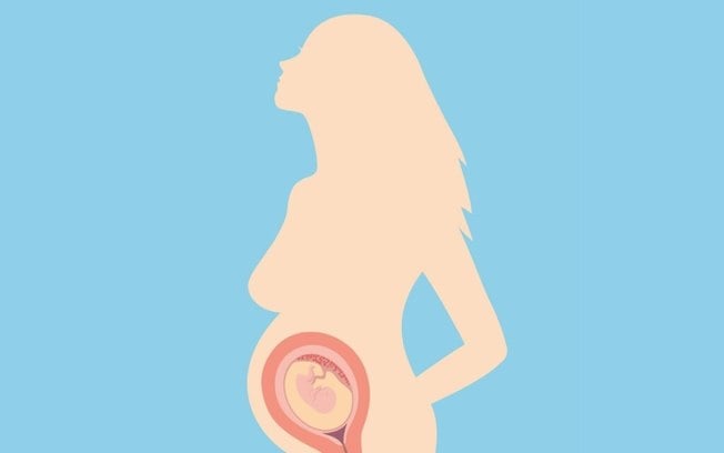 Cerclagem uterina: entenda sobre cirurgia que evita parto prematuro
