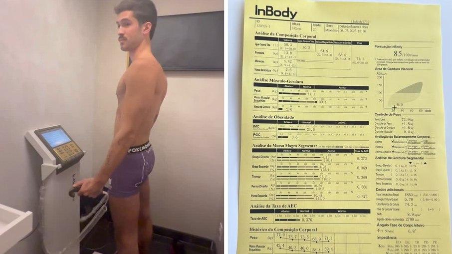 João Guilherme perde seis quilos e mostra exame de cueca do Pokémon João Guilherme perde seis quilos e mostra exame de cueca do Pokémon
