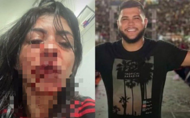 Diego Dasmaceno se entregou à polícia após agredir a companheira Diego Dasmaceno se entregou à polícia após agredir a companheira