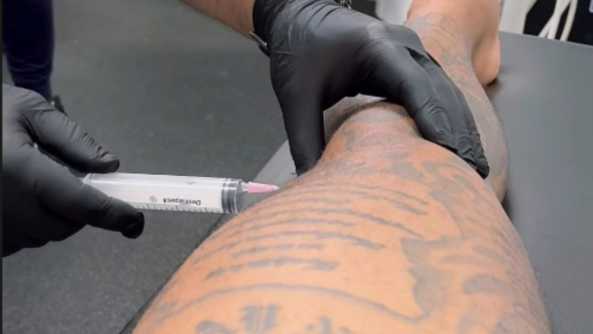 Memphis compartilhou momento que passou pela punção articular