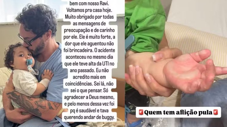 Eliezer%20atualiza%20sa%C3%BAde%20do%20filho%20ap%C3%B3s%20cirurgia%20por%20queimadura