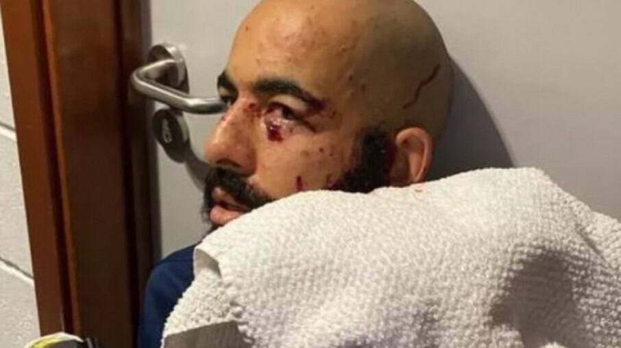 Esposa de Danilo Fernandes publica nova foto do goleiro após ataque ao ônibus do Bahia: 'Sem acreditar'