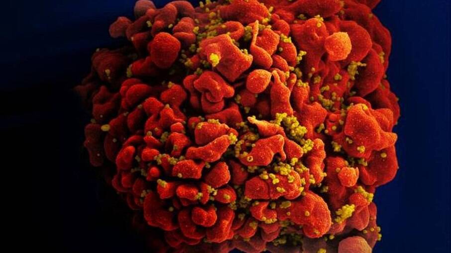 Micrografia eletrônica mostra uma célula T H9 infectada com HIV