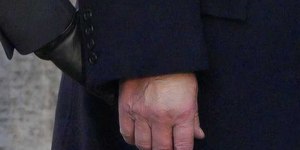 Maquiagem na mão de Trump levanta suspeita sobre sua saúde