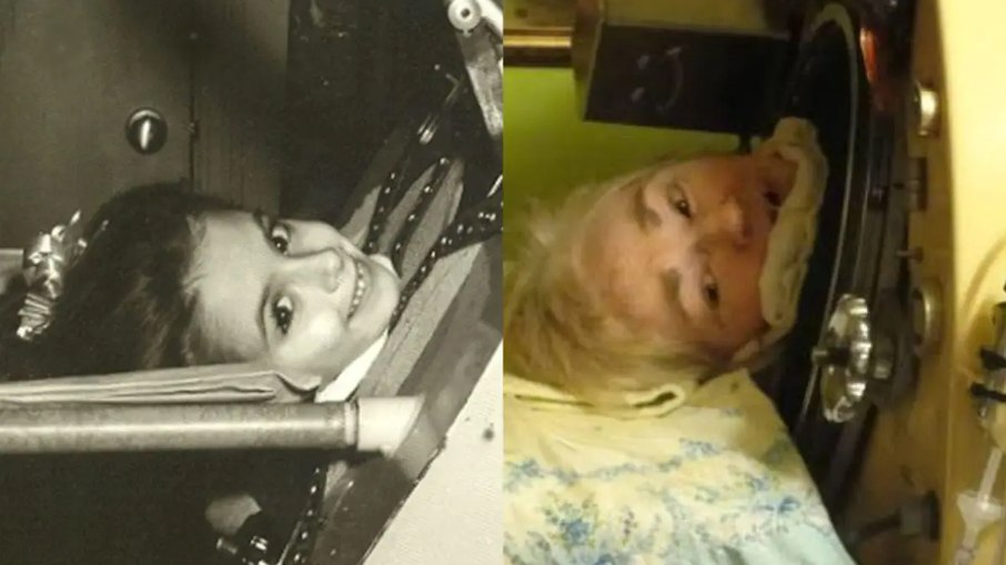 Martha morreu em 26 de junho de 2026, aos 78 anos, em Shawnee, Oklahoma, tornando-se a última norte-americana a viver graças a um pulmão de aço. Martha morreu em 26 de junho de 2026, aos 78 anos, em Shawnee, Oklahoma, tornando-se a última norte-americana a viver graças a um pulmão de aço.
