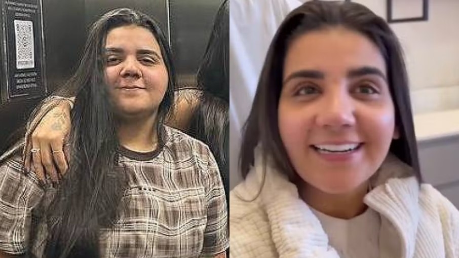 Antes e depois de Yasmin Santos Antes e depois de Yasmin Santos