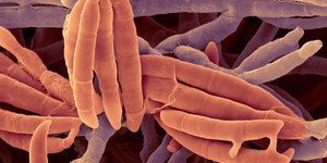 Fungo intestinal pode ser a chave para tratar doença hepática