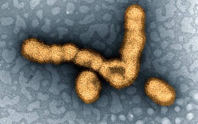 Partículas do vírus da gripe suína (H1N1) vistos através de microscópio eletrônico