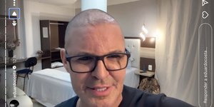 Eduardo Costa surpreende fãs ao surgir careca em show