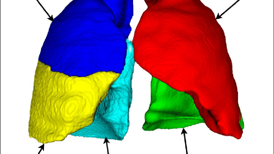 A ferramenta pode tornar as análises mais rápidas, precisas e padronizadas, reduzindo a necessidade de estimativas visuais feitas pelos especialistas A ferramenta pode tornar as análises mais rápidas, precisas e padronizadas, reduzindo a necessidade de estimativas visuais feitas pelos especialistas