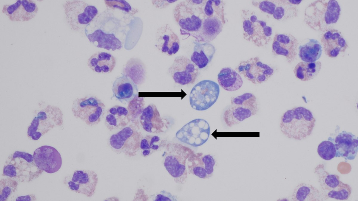 A Naegleria fowleri entra pelo nariz, alcança o cérebro e consome o tecido cerebral A Naegleria fowleri entra pelo nariz, alcança o cérebro e consome o tecido cerebral