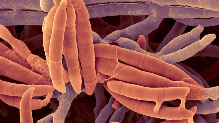 Fungo intestinal pode ser a chave para tratar doença hepática